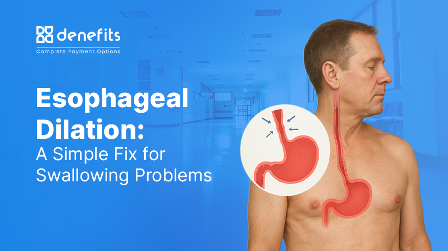 Esophageal-Dilation