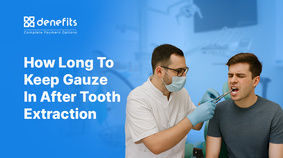 How Long to Keep Gauze In After Tooth Extraction