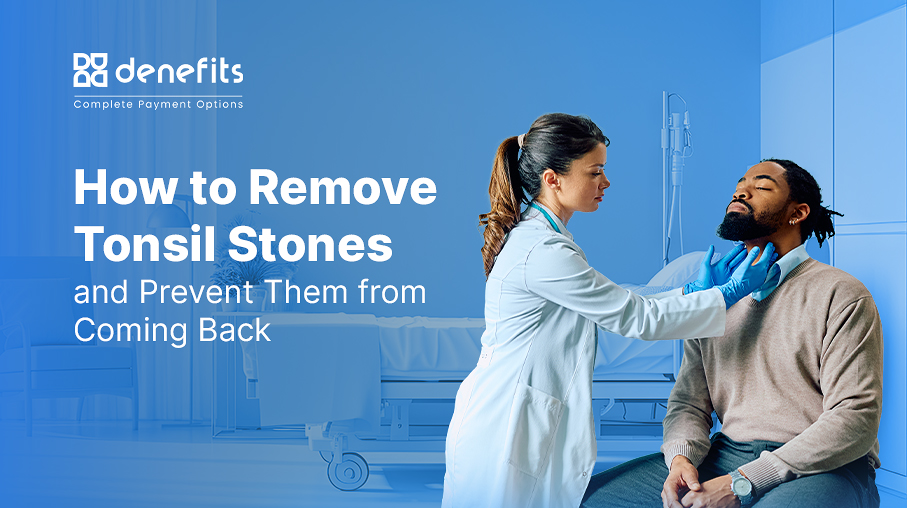 How-to-Remove-Tonsil-Stones