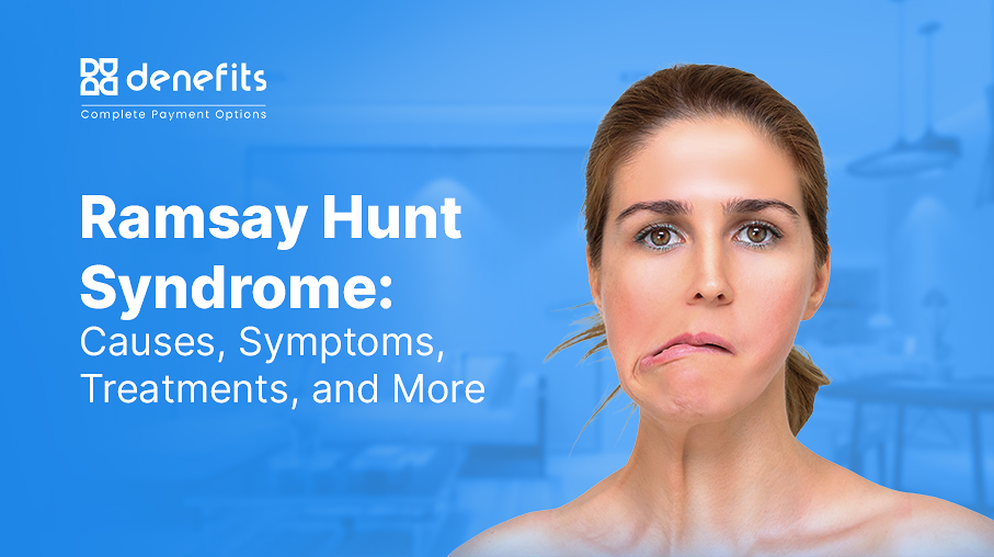 Ramsay-Hunt-Syndrome